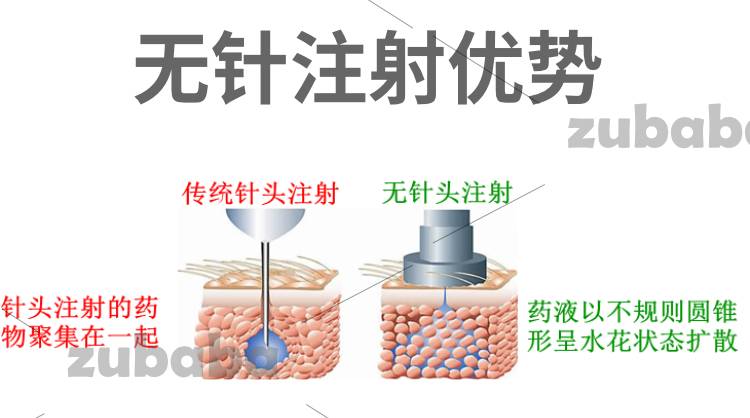 MIRAJET 100电动无针注射器 MIRACLESCOPE兽用连续注射器 育肥舍 分娩舍 保育舍 进口注射器 MIRAJET 100电动无针注射器 MIRACLESCOPE兽用连续注射器 育肥舍 分娩舍 保育舍 进口注射器